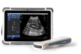 Portable Ultrasound Machines