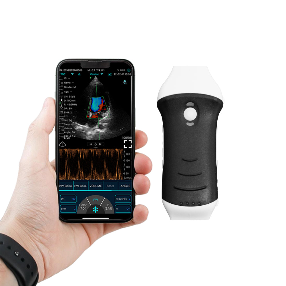 Portable Pocket Ultrasound System C10HL