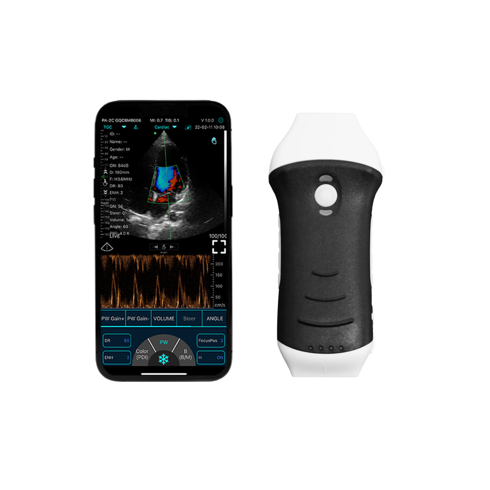 Portable Pocket Ultrasound System C10HL
