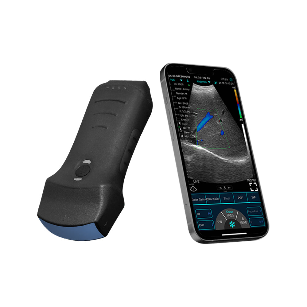 Portable Ultrasound System C10TX