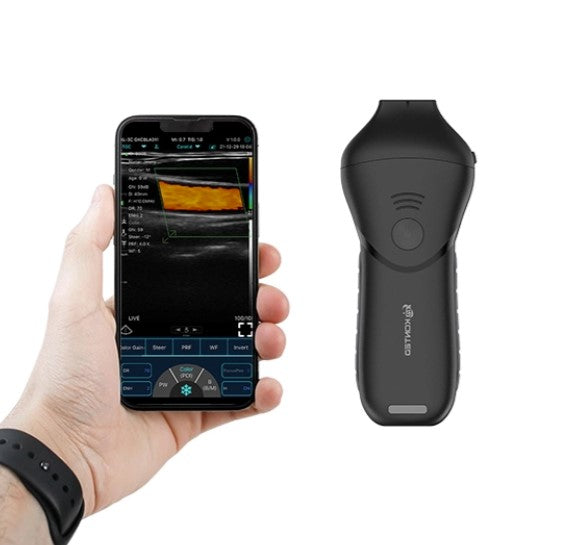 Portable Pocket Ultrasound System C10MB Pro – BKMedStore